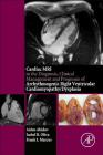 Cardiac MRI in Diagnosis, Clinical Management, and Prognosis of Arrhythmogenic Right Ventricular Cardiomyopathy/Dysplasia By Aiden Abidov, Isabel Oliva, Frank I. Marcus Cover Image