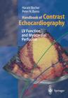 Handbook of Contrast Echocardiography: Left Ventricular Function and Myocardial Perfusion By S. Kaul (Foreword by), Harald Becher, Peter N. Burns Cover Image