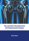 Hip and Knee Reconstructive and Replacement Surgery By Oscar Hazel (Editor) Cover Image