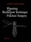Planning and Reduction Technique in Fracture Surgery By H. Willenegger (Foreword by), Jeffrey Mast, J. P. Imken (Illustrator) Cover Image