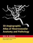 3D Angiographic Atlas of Neurovascular Anatomy and Pathology By Neil M. Borden Cover Image