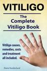 Vitiligo. Vitiligo causes, remedies, costs and treatment all included. The complete Vitiligo Book. Cover Image
