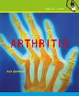 Arthritis (Health Alert) Cover Image