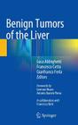 Benign Tumors of the Liver By Luca Aldrighetti (Editor), Francesco Cetta (Editor), Gianfranco Ferla (Editor) Cover Image