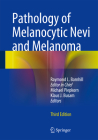 Pathology of Melanocytic Nevi and Melanoma By Raymond L. Barnhill (Editor), Michael W. Piepkorn (Editor), Klaus J. Busam (Editor) Cover Image
