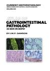 Atlas of Gastrointestinal Pathology: As Seen on Biopsy (Current Histopathology #6) By M. Dawson, T. Morson Cover Image