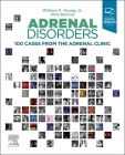 Adrenal Disorders: 100 Cases from the Adrenal Clinic By William F. Young, Irina Bancos Cover Image