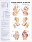Understanding Arthritis Anatomical Chart Cover Image