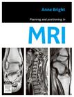 Planning and Positioning in MRI Cover Image