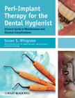 Peri-Implant Therapy for the Dental Hygienist: Clinical Guide to Maintenance and Disease Complications By Susan S. Wingrove Cover Image