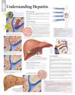 Understanding Hepatitis Chart: Laminated Wall Chart Cover Image
