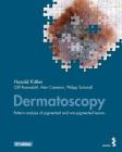 Dermatoscopy: Pattern analysis of pigmented and non-pigmented lesions By Harald Kittler, Cliff Rosendahl, Alan Cameron Cover Image