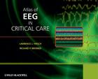 Atlas of EEG in Critical Care By Lawrence J. Hirsch (Editor), Richard Brenner (Editor) Cover Image