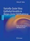 Varicella-Zoster Virus Epithelial Keratitis in Herpes Zoster Ophthalmicus: In Vivo Morphology in the Human Cornea Cover Image