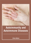 Autoimmunity and Autoimmune Diseases By Chloe Weber (Editor) Cover Image