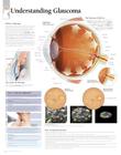 Understanding Glaucoma Chart: Laminated Wall Chart Cover Image