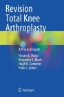 Revision Total Knee Arthroplasty: A Practical Guide By Hosam E. Matar, Benjamin V. Bloch, Hugh U. Cameron Cover Image