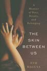 The Skin Between Us: A Memoir of Race, Beauty, and Belonging By Kym Ragusa Cover Image