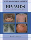 Hiv/ Aids: Atlas of Investigation and Management Cover Image