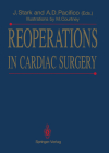 Reoperations in Cardiac Surgery Cover Image