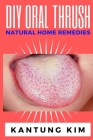 DIY Oral Thrush Natural Home Remedies: The Effective Step By Step Guide To Permanently End Oral Thrush By Kantung Kim Cover Image