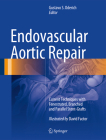 Endovascular Aortic Repair: Current Techniques with Fenestrated, Branched and Parallel Stent-Grafts By Gustavo S. Oderich (Editor), David Factor (Illustrator) Cover Image