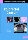 Colorectal Cancer (Contemporary Issues in Cancer Imaging) By Gina Brown (Editor) Cover Image