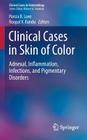 Clinical Cases in Skin of Color: Adnexal, Inflammation, Infections, and Pigmentary Disorders (Clinical Cases in Dermatology) By Porcia B. Love (Editor), Roopal V. Kundu (Editor) Cover Image