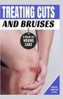 Treating Cuts and Bruises: A Book on Wound Care By Paolo Jose De Luna Cover Image