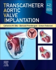 Transcatheter Aortic Valve Implantation Cover Image