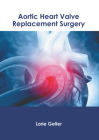 Aortic Heart Valve Replacement Surgery Cover Image