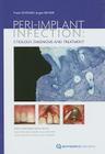 Peri-Implant Infection: Etiology, Diagnosis and Treatment By Frank Schwarz Cover Image