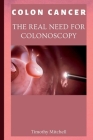 Colon Cancer: The Real Need for Colonoscopy By Timothy Mitchell Cover Image