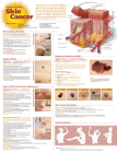 Understanding Skin Cancer Anatomical Chart Cover Image