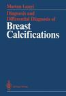 Diagnosis and Differential Diagnosis of Breast Calcifications By Terry C. Telger (Translator), Marton Lanyi Cover Image