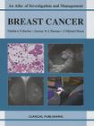 Breast Cancer: An Atlas of Investigation and Management (Atlases of Investigation and Management) Cover Image