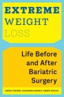 Extreme Weight Loss: Life Before and After Bariatric Surgery By Sarah Trainer, Alexandra Brewis, Amber Wutich Cover Image