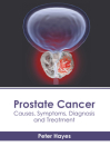 Prostate Cancer: Causes, Symptoms, Diagnosis and Treatment By Peter Hayes (Editor) Cover Image