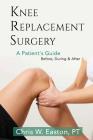 Knee Replacement Surgery, A Patient's Guide: Before, During & After Cover Image