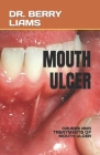 Mouth Ulcer: Causes and Treatments of Mouth Ulcer By Berry Liams Cover Image