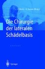 Die Chirurgie Der Lateralen Schadelbasis By Friedrich Bootz (Editor), Gero Strauss (Editor) Cover Image