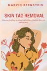 Skin Tag Removal: Discover the Key to Achieving Radiant, Youthful Skin the Natural Way Cover Image