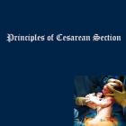 Principles of Cesarean Section By Naira R. Matevosyan Cover Image