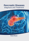 Pancreatic Diseases: Diagnosis and Treatment By Rosie Mason (Editor) Cover Image