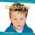 Chickenpox (Head-To-Toe Health) By Elaine Landau Cover Image