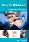 Open-Bite Malocclusion: Treatment and Stability By Guilherme Janson (Editor), Fabricio Valarelli (Editor) Cover Image