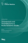 Thrombolysis and Thrombectomy in Acute Ischemic Stroke Cover Image