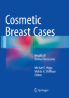 Cosmetic Breast Cases: Results of Online Discussions By Michael J. Higgs (Editor), Melvin a. Shiffman (Editor) Cover Image
