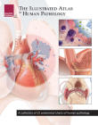 The Illustrated Atlas of Human Pathology: A Collection of 25 Anatomical Charts of Human Pathology By Scientific Publishing (Other) Cover Image